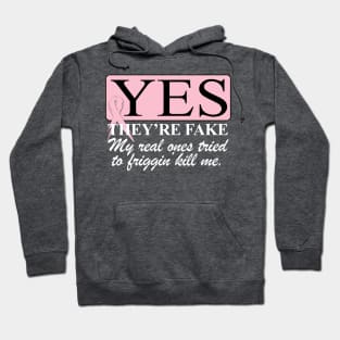 Yes, they're FAKE  My real ones tried to kill me Hoodie